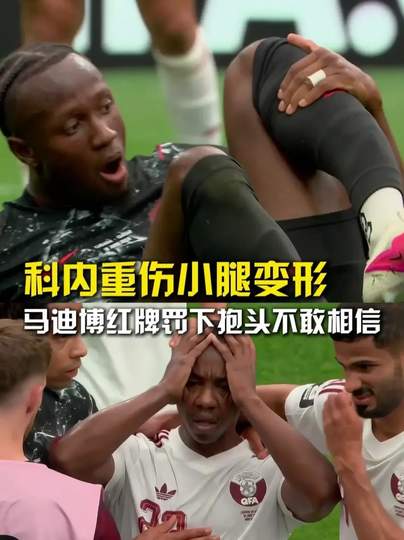 加拿大球员小腿恐怖变形，CBA历史受伤榜单再添惨烈一页